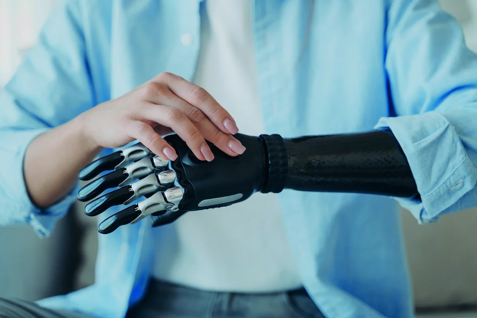 Cyber hand of female amputee. Disabled woman is changing settings of robotic prosthesis.